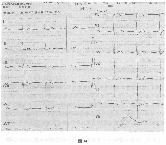 患者男47岁因突发胸背部疼痛9h住院〖者于9h前1420洗澡时