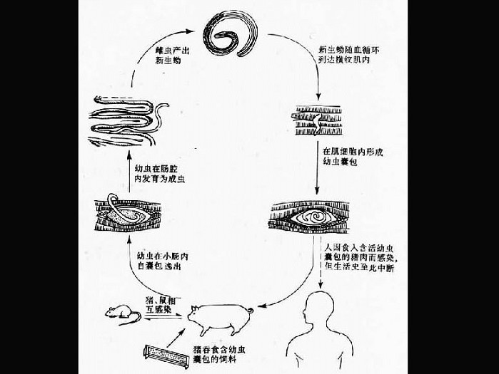 旋毛虫幼虫手绘图图片